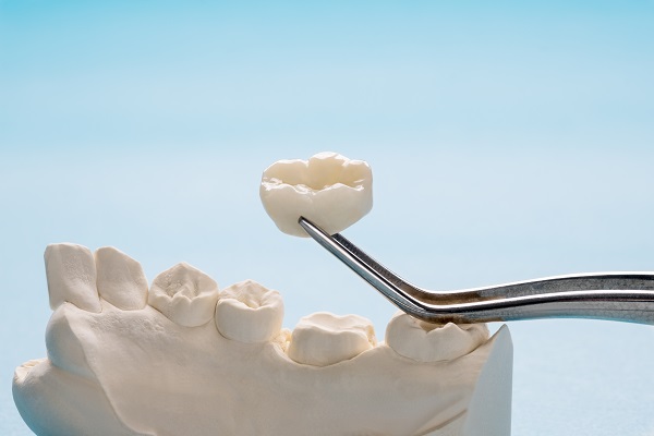 Dental Crowns &# ; How To Identify When Something Is Wrong